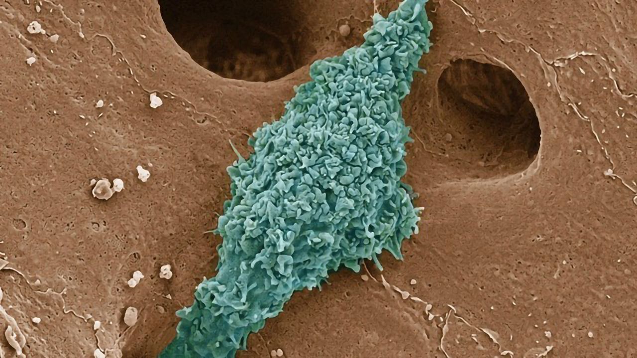 A Kupfer Cell