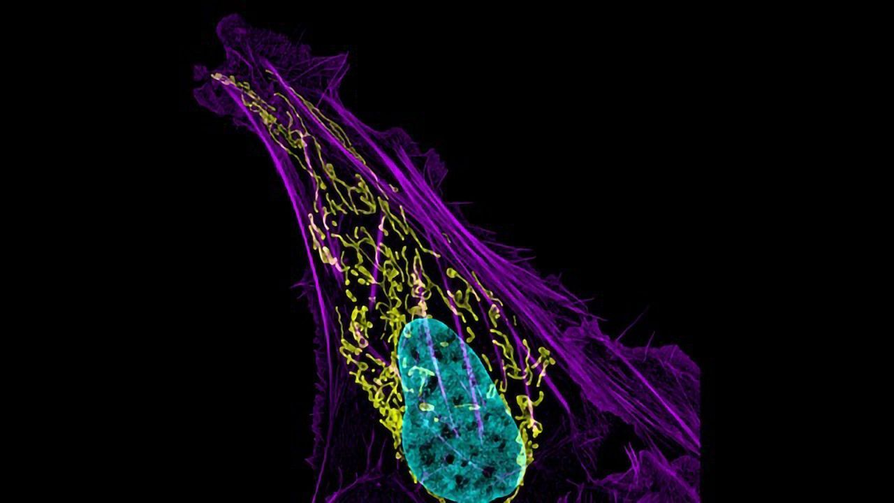 Bone Cancer Cell