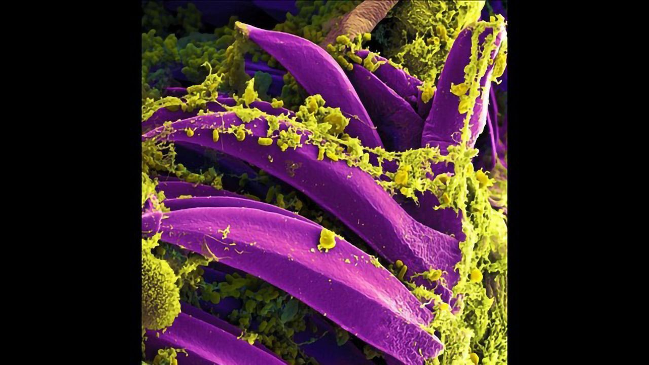 Yersinia Pestis