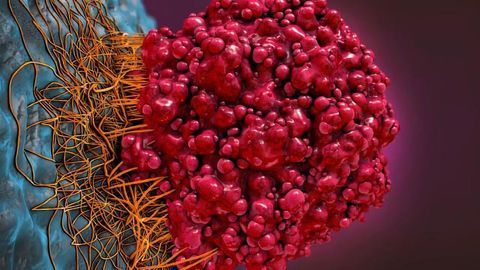 Unprecedented Insight into Potential Anticancer Drug Target