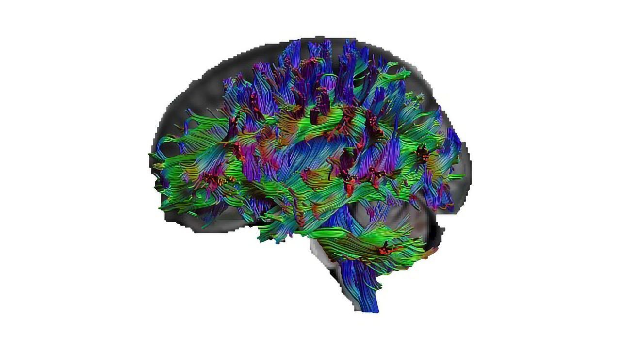 Got Great General Knowledge? Here's What Your Brain Looks Like