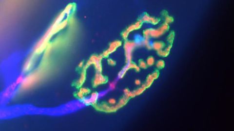 How Neuromuscular Connections Are Maintained After Nerve Lesions