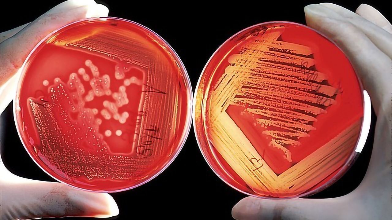 Wide Potential for Self-sterilizing Polymer