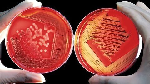 Wide Potential for Self-sterilizing Polymer