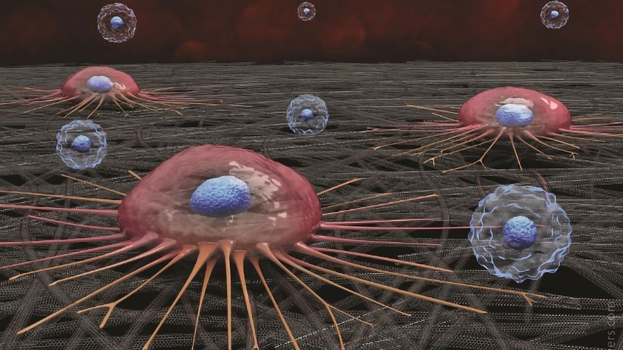Liquid Biopsy Chip Isolates CTCs With High Purity