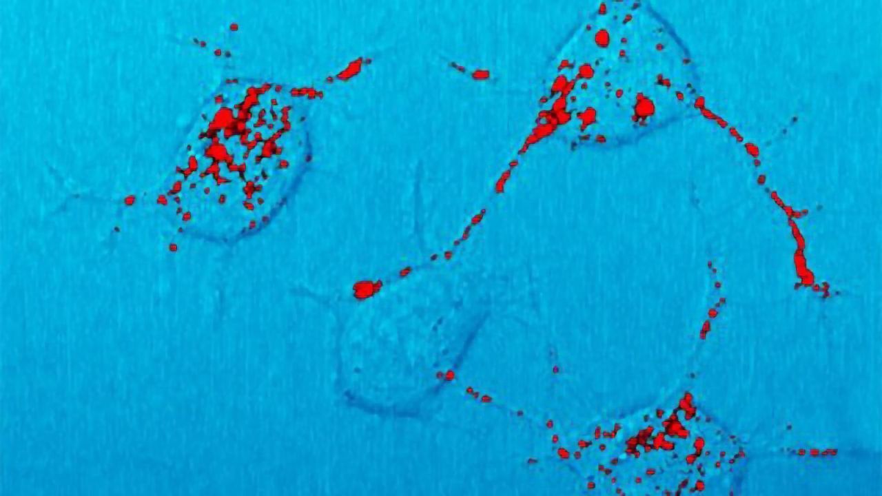 Antisense Therapy Slows Down Mouse Prion Disease