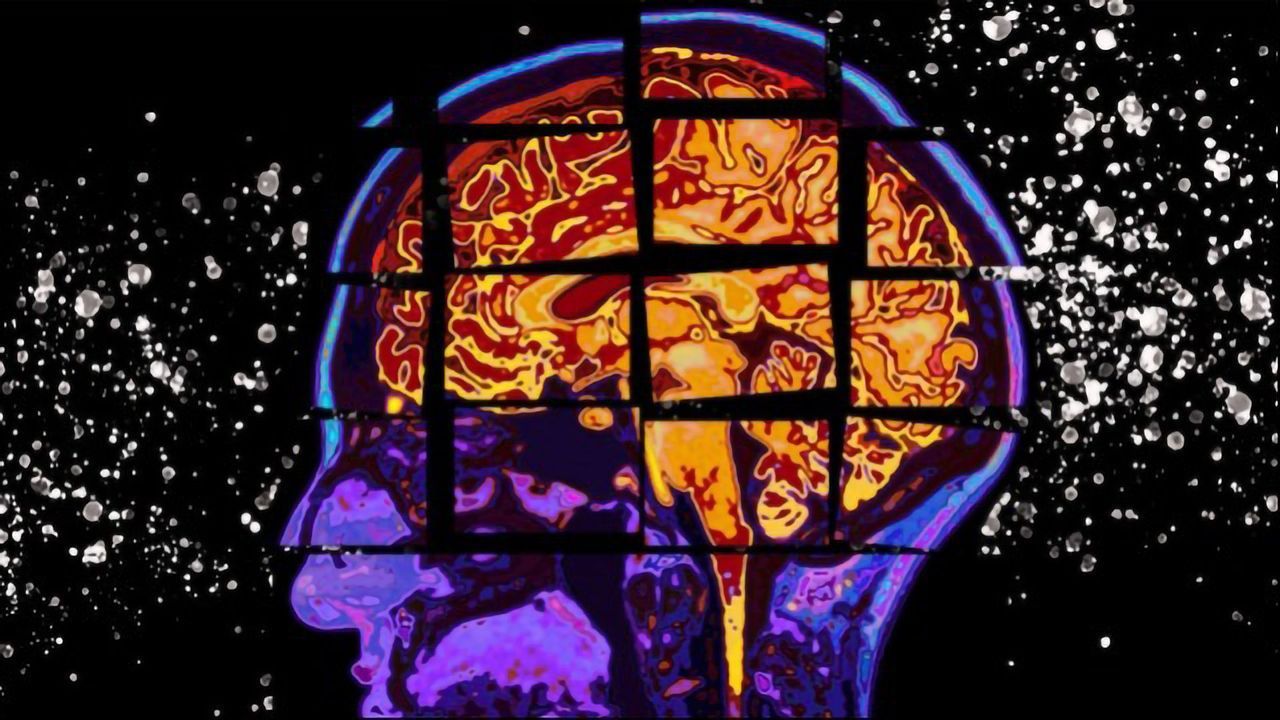 Data Model Predicts Alzheimer's Cognitive Decline