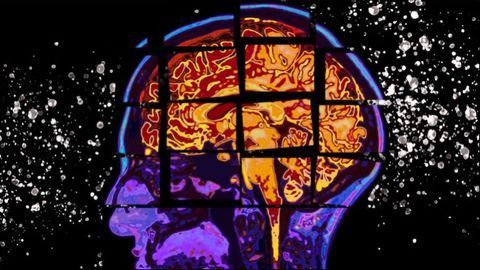Data Model Predicts Alzheimer's Cognitive Decline