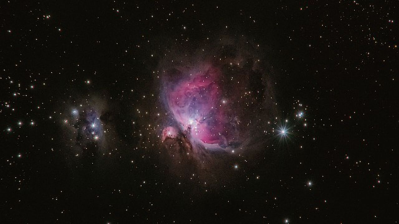 What Will Happen to the Brain in Deep Space?