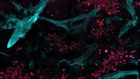 Spotting Cancer at the Molecular Level