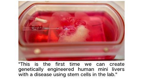 World-first: Genetically Modified Miniature Human Livers Are Grown in the Laboratory
