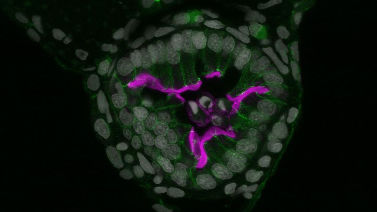 Gut Throws Cells Overboard When Chemical Insults Build Up