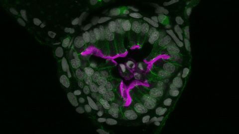 Gut Throws Cells Overboard When Chemical Insults Build Up