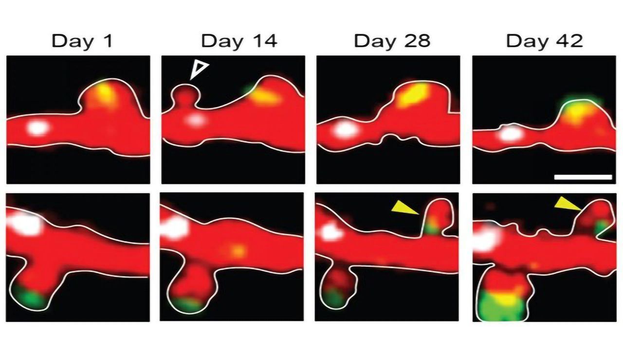 Which Connections to Keep? How the Brain Makes Its Choice