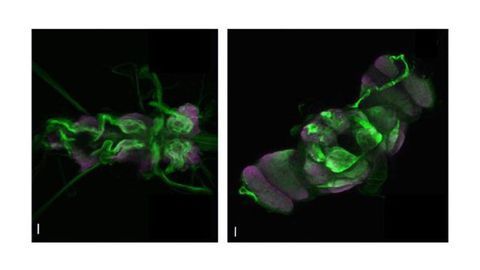 Seizures Associated With Cardiac Disease: What Role Does Genetics Play?
