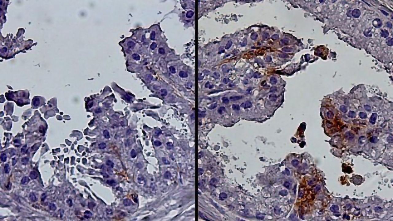 Progenitor Cells Linked to Age-related Prostate Growth