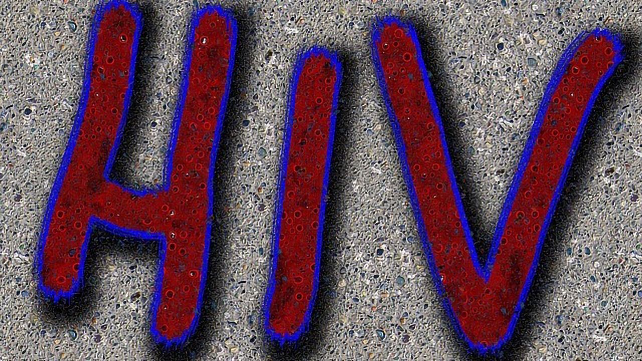 Living With HIV Increases Risk of Other Health Issues