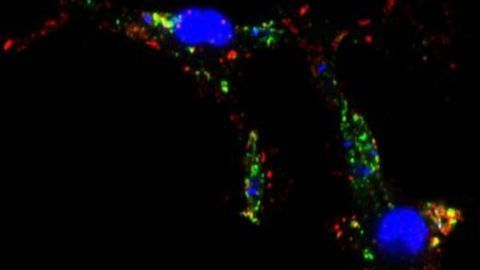 Virulence Strategy of Leishmania Revealed