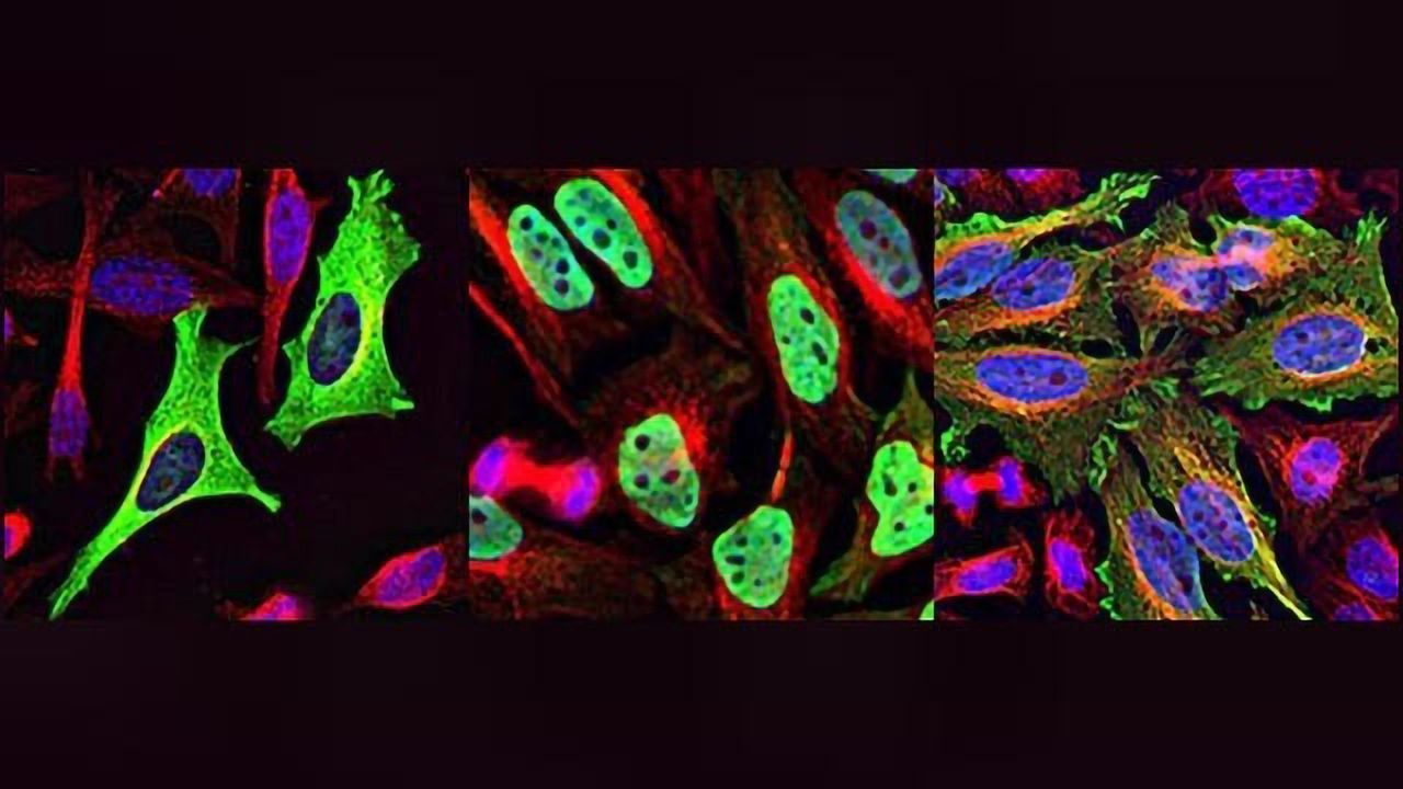 PHLPP1 Enzyme: A Target for New Sepsis Drugs