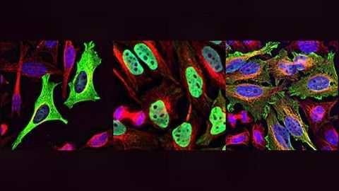 PHLPP1 Enzyme: A Target for New Sepsis Drugs