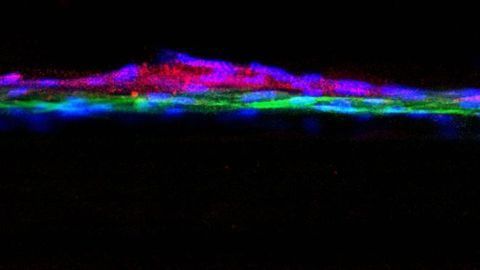 Breakthrough Model of Human Kidney Developed