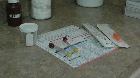 Better Tests Needed for Urinary Tract Infections