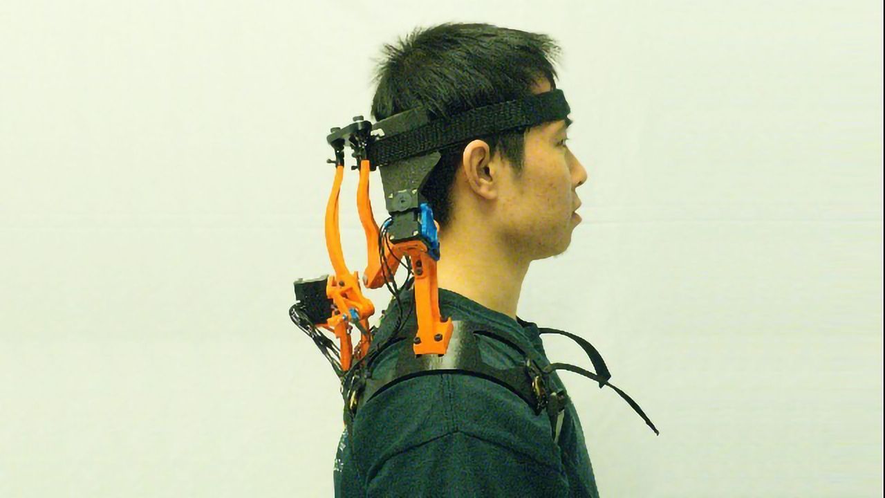 Robotic Neck Brace Restores Function for ALS Patients