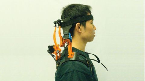 Robotic Neck Brace Restores Function for ALS Patients