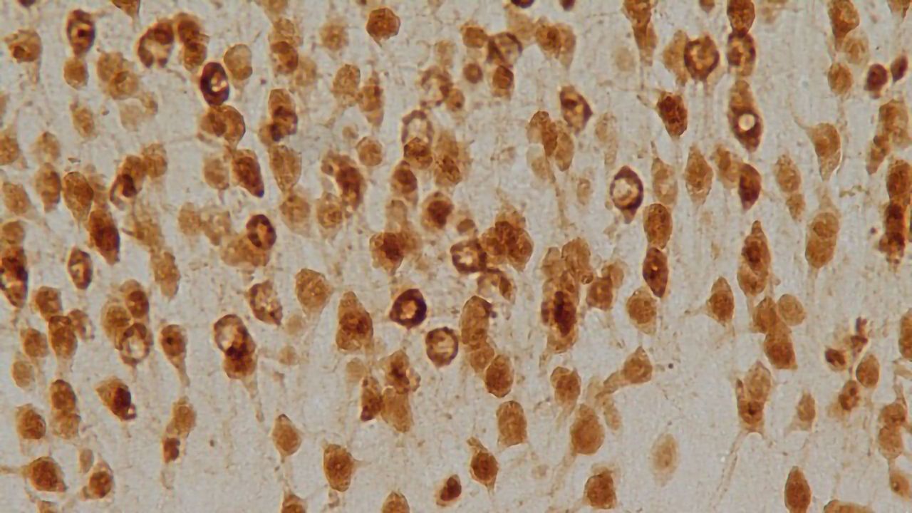 Immunohistochemistry: Tips and Techniques To Save Time, Money, and Tissue
