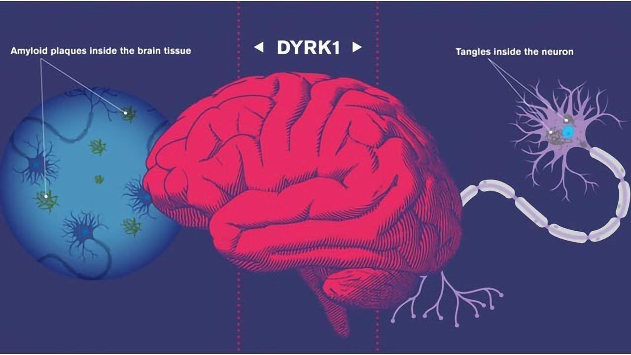 Drug Targets Early Instigator of Alzheimer's Disease