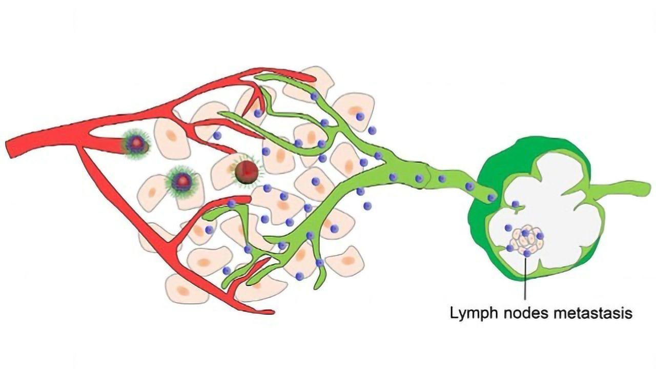 Nanoparticle Drugs Pass Through Lymphatics to Destroy Metastases