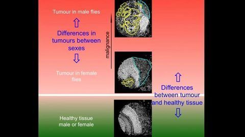 Genes Responsible for Sex-related Differences in Cancer Aggressiveness ID’d