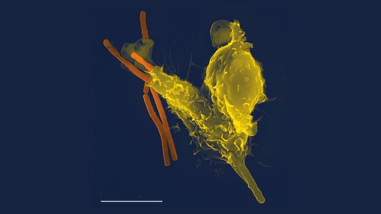 Study to Investigate Links Between Immune System and Mental Health