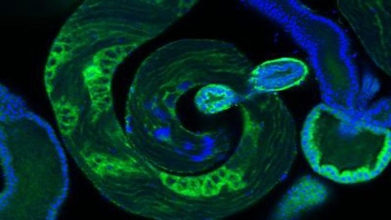 Flies' Tiny Testes Are Hotspots for the Emergence of New Genes