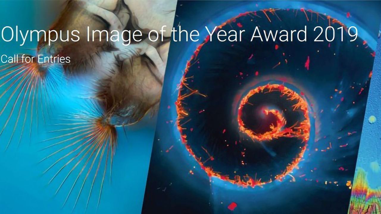 The Art of Science: Olympus Launches the First Global Image of the Year Award