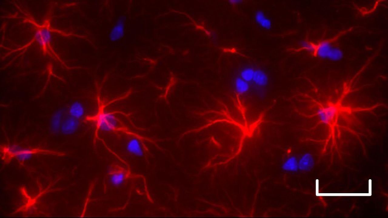 When a Malfunctioning Liver Can Lead to Brain Damage