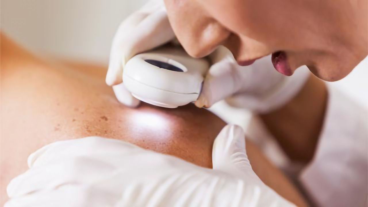 $1.7 Million Grant to Study Potential Skin Cancer Treatment