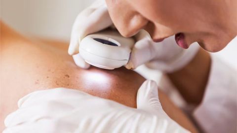 $1.7 Million Grant to Study Potential Skin Cancer Treatment