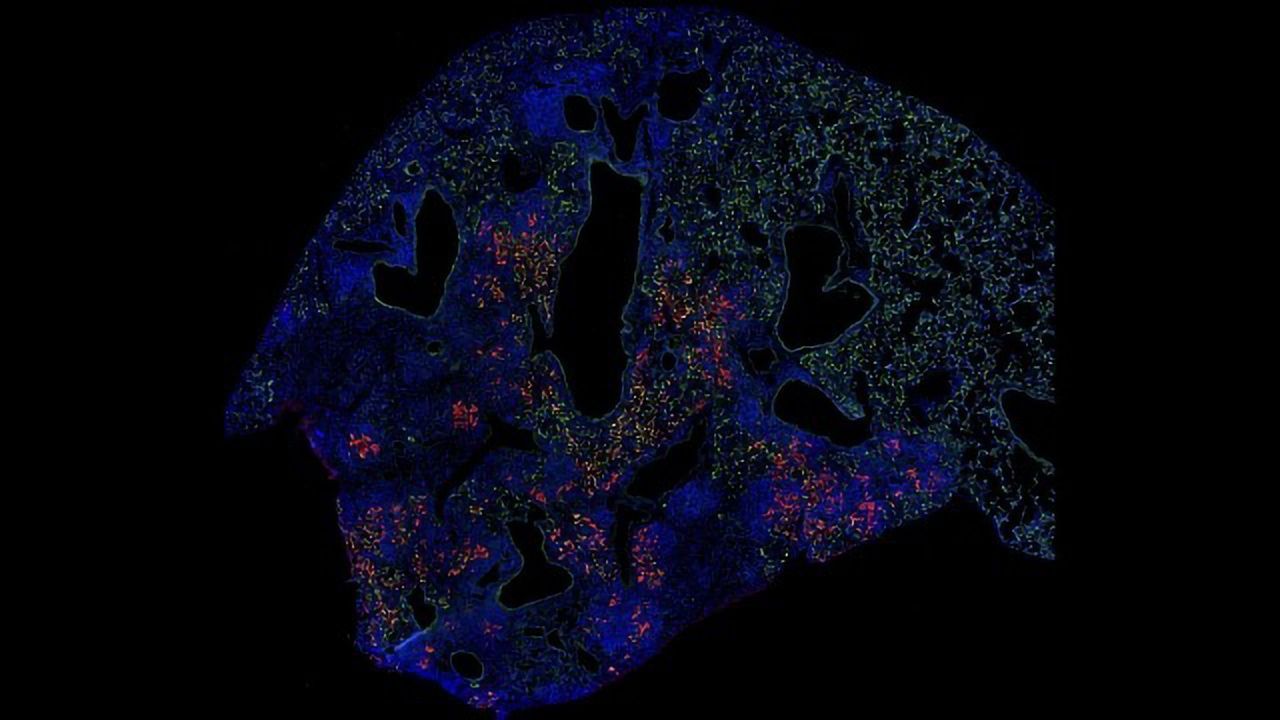Lung Cell Transplant Boosts Healing After the Flu
