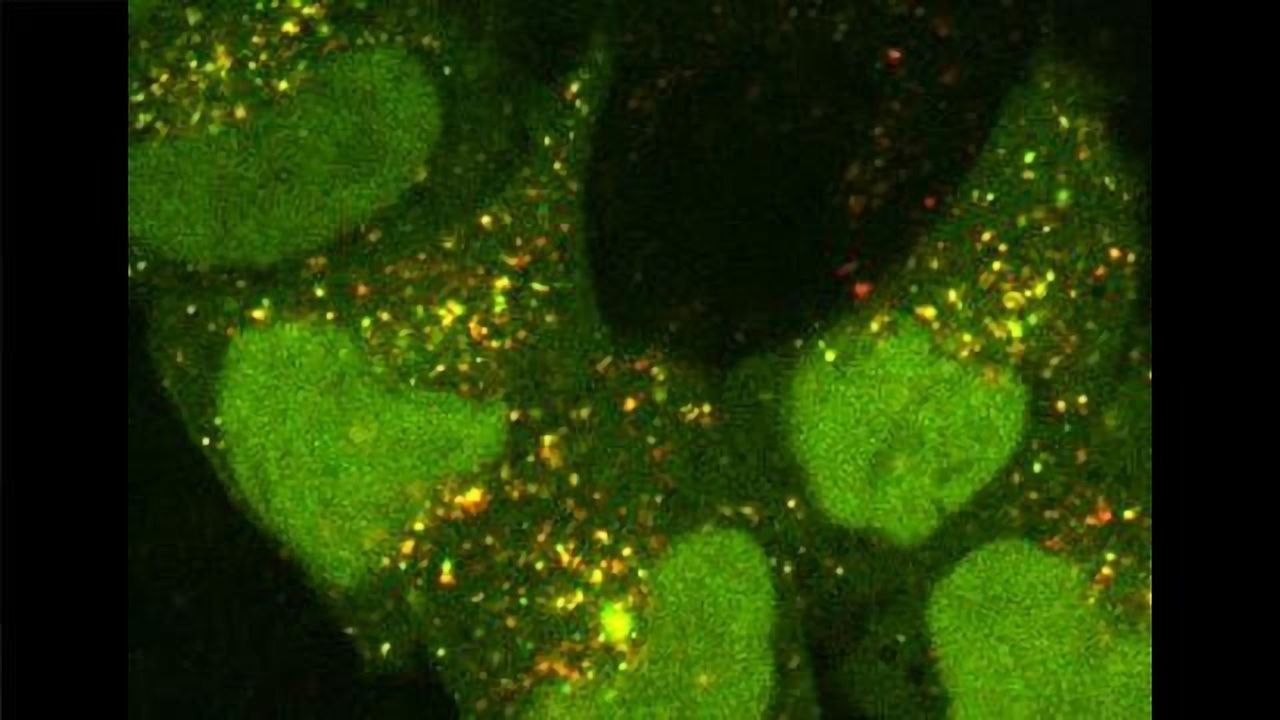 Studying Cells’ “Self-eating” Could Help Create New Dementia Drugs