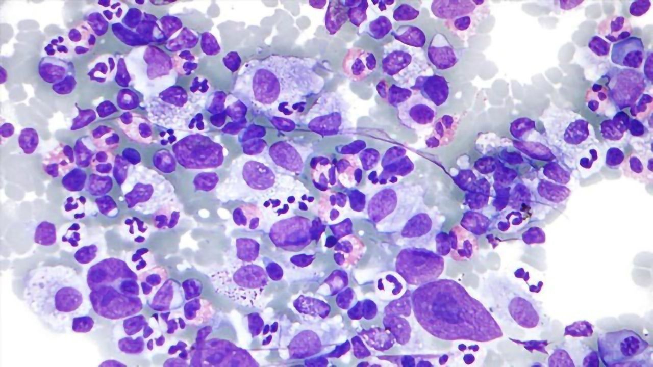 First-degree Relatives of Blood Cancer Patients at Greater Risk