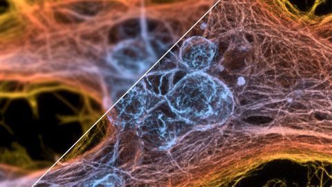 Algorithm Helps Microscopes Reach Their Full Potential