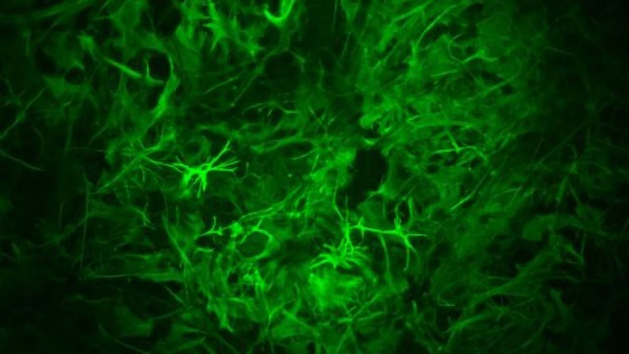 Astrocytes Play Surprising Role in Long-Term Memory Formation in Mice