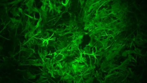 Astrocytes Play Surprising Role in Long-Term Memory Formation in Mice