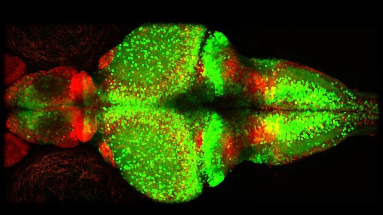 New Study Illustrate Role of Glial Cells in Epileptic Seizures and Provides Potential for new Therapies