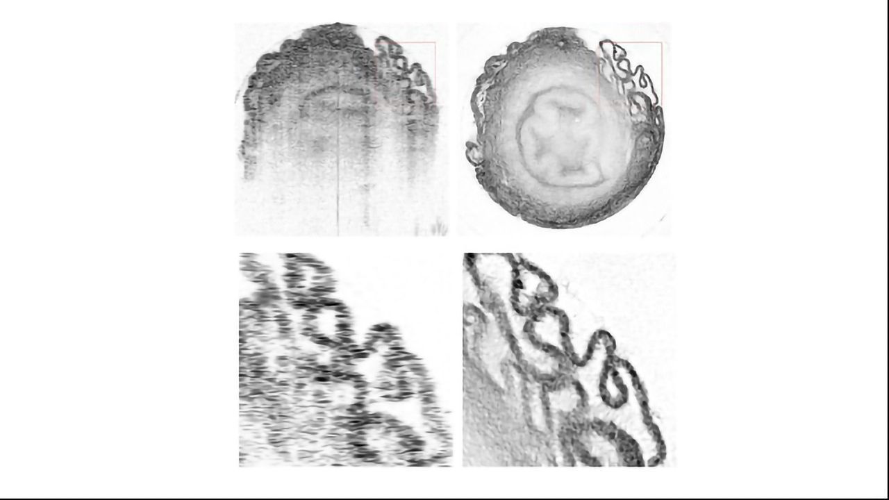 Machine Learning Tool Helps Optical Tomography Reaches Micrometer Resolution
