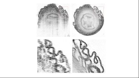 Machine Learning Tool Helps Optical Tomography Reaches Micrometer Resolution
