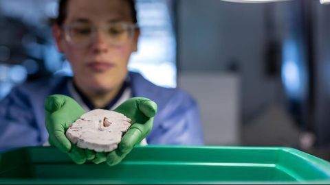 "Parts List for the Brain" Could Aid Treatments