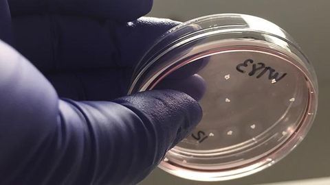 Brain Waves Detected in Lab Grown Mini-brains