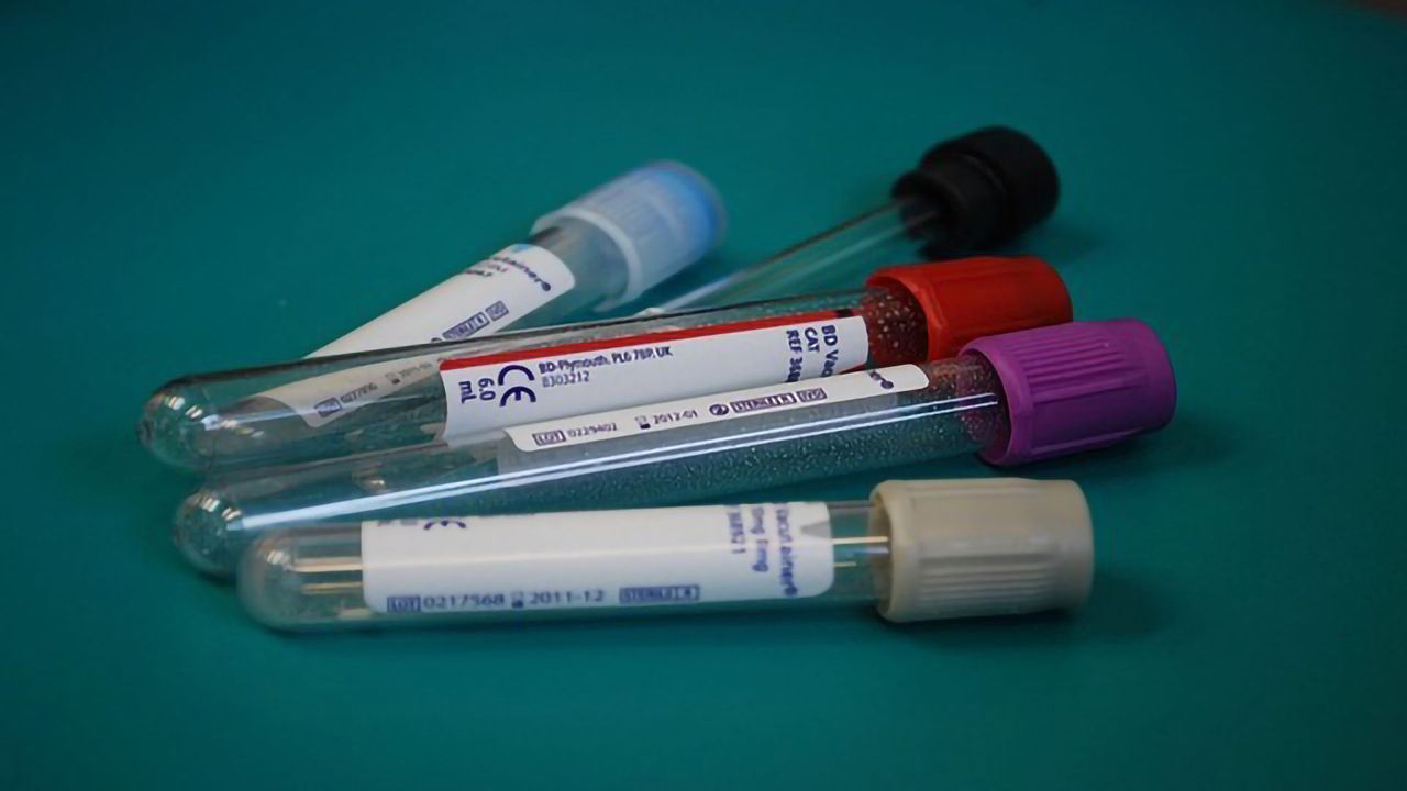 Cell-free DNA: A Simple, Low Cost Approach to Detect Pathogens and Quantify Tissue Damage